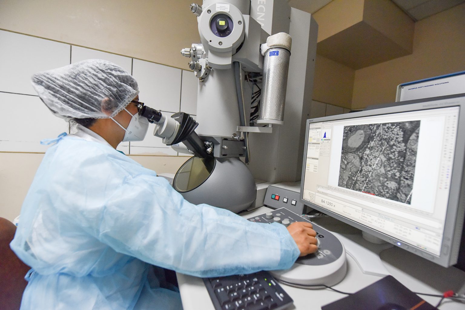 INSN SAN BORJA BRINDA ESTUDIOS DE MICROSCOPÍA ELECTRÓNICA DE