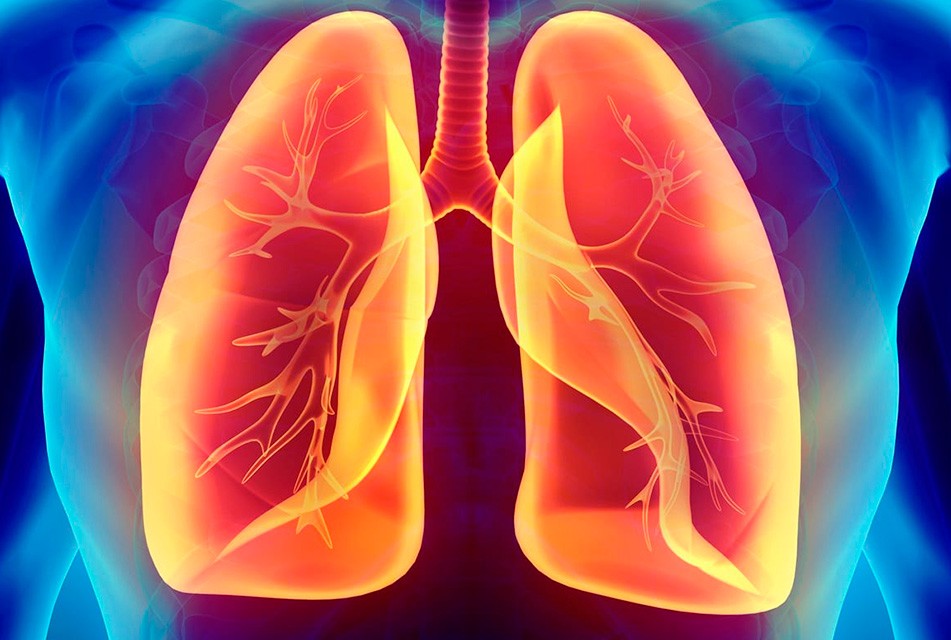 QUÉ HACER SI TIENES FALTA DE AIRE Y FATIGA PERSISTENTE: PODRÍA SER HIPERTENSIÓN ARTERIAL PULMONAR