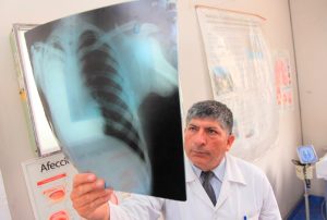 MINSA: CON DIAGNÓSTICO TEMPRANO Y ATENCIÓN INTEGRAL, LA TUBERCULOSIS PUEDE CURARSE