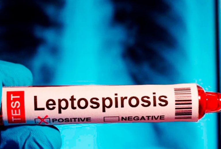LEPTOSPIROSIS SE ACELERA EN PIURA: CONTAGIOS SUPERAN LOS 100 POR SEMANA Y YA SUMAN 436 CASOS, ADVIERTE MÉDICO JULIO BARRENA
